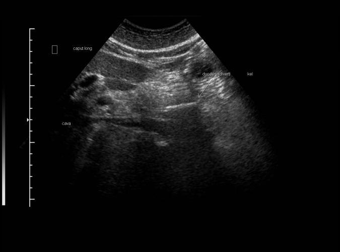 4b av  Catherine Olsson, sonograf